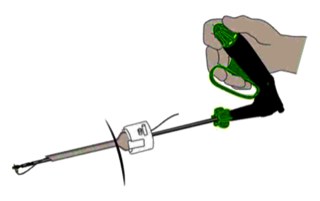VisONE lead placement tool